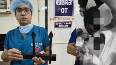 Photo of KGMU के डॉक्टरों ने किया चमत्कार, मासूम को मौत के मुंह से निकाला